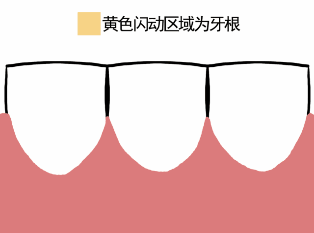 牙龈萎缩怎么恢复-牙龈萎缩该怎么办呢?-大智网汇