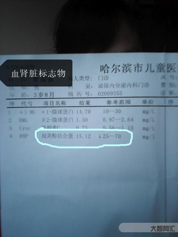 糖化血红蛋白高是什么意思-关于糖化血红蛋白,必须绕开这5个误区-大智网汇
