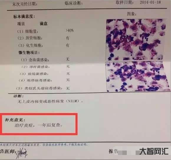 tct检查什么项目-宫颈炎应该做什么检查-大智网汇