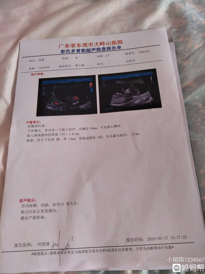 nt检查什么内容-「妇幼科普」NT报告看不懂?超声医学专家为您解读-大智网汇