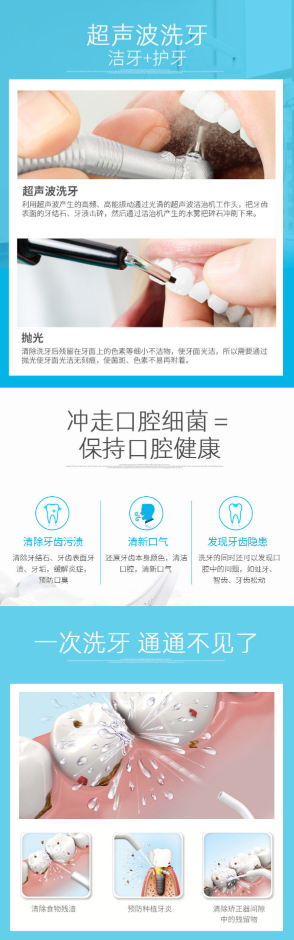 洗牙一次大概多少钱-去了一趟牙科,1.2万没有了-大智网汇
