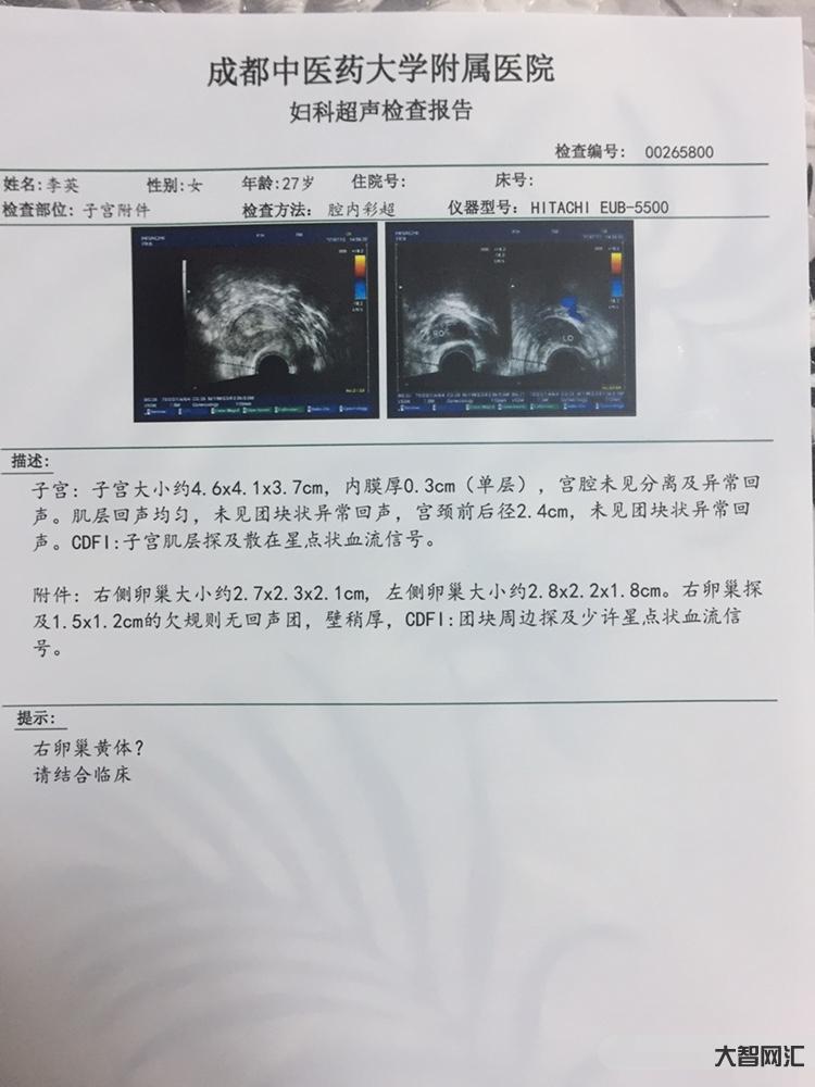 子宫内膜厚度多少正常-【女性频道】子宫内膜ABC-大智网汇