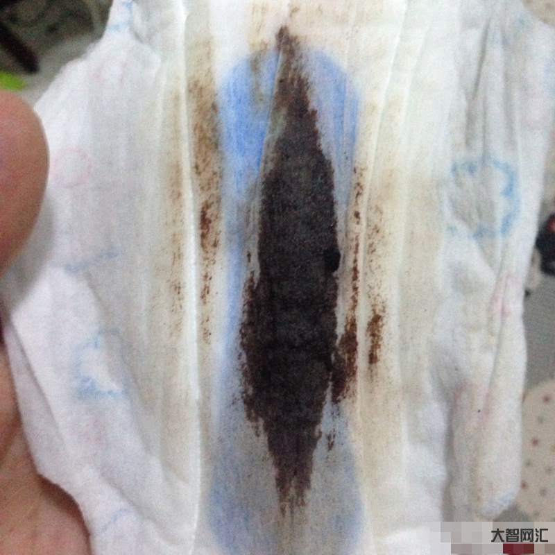 月经量少颜色黑褐色是什么原因-月经发黑量少怎么调理?-大智网汇