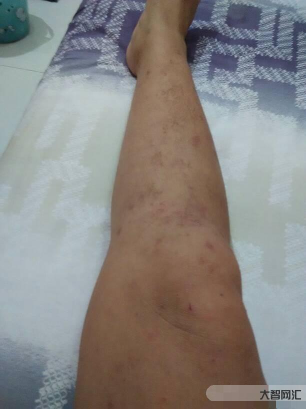 几天没c是不是b又痒了-缺什么营养,一看便知!10秒钟自测,所有人都该-大智网汇