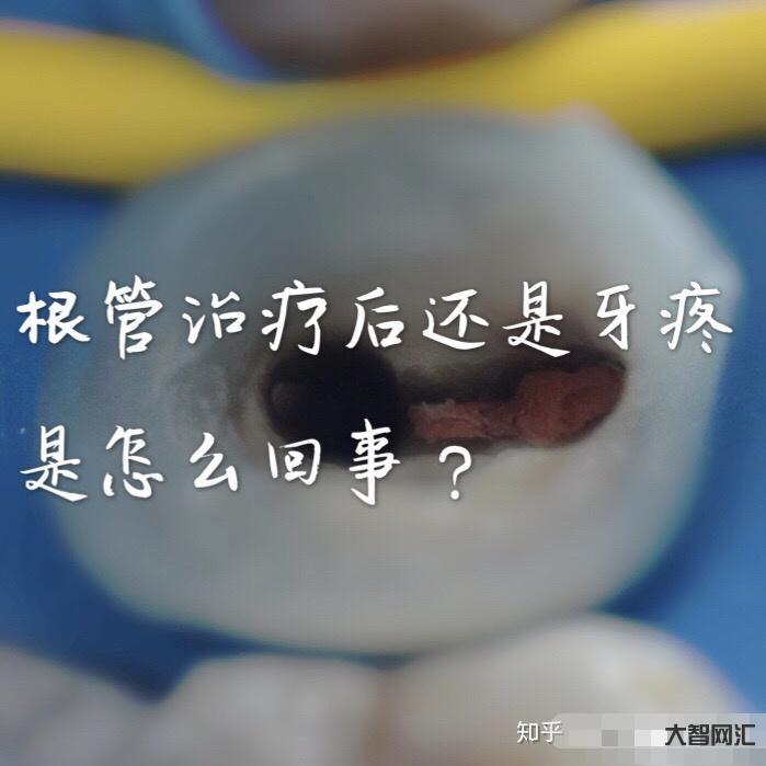 根管治疗多少钱一颗牙-为啥根管治疗这么贵,是不是被坑了?-大智网汇