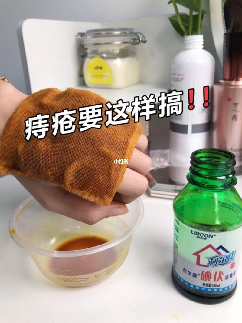 痔疮外痔肉球怎么消除-孕期痔疮犯了怎么办?几招教你轻松缓解-大智网汇