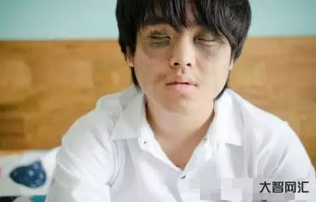 肾虚的表现症状有哪些-男人肾虚会有哪些表现?这几种很常见,别大意了-大智网汇