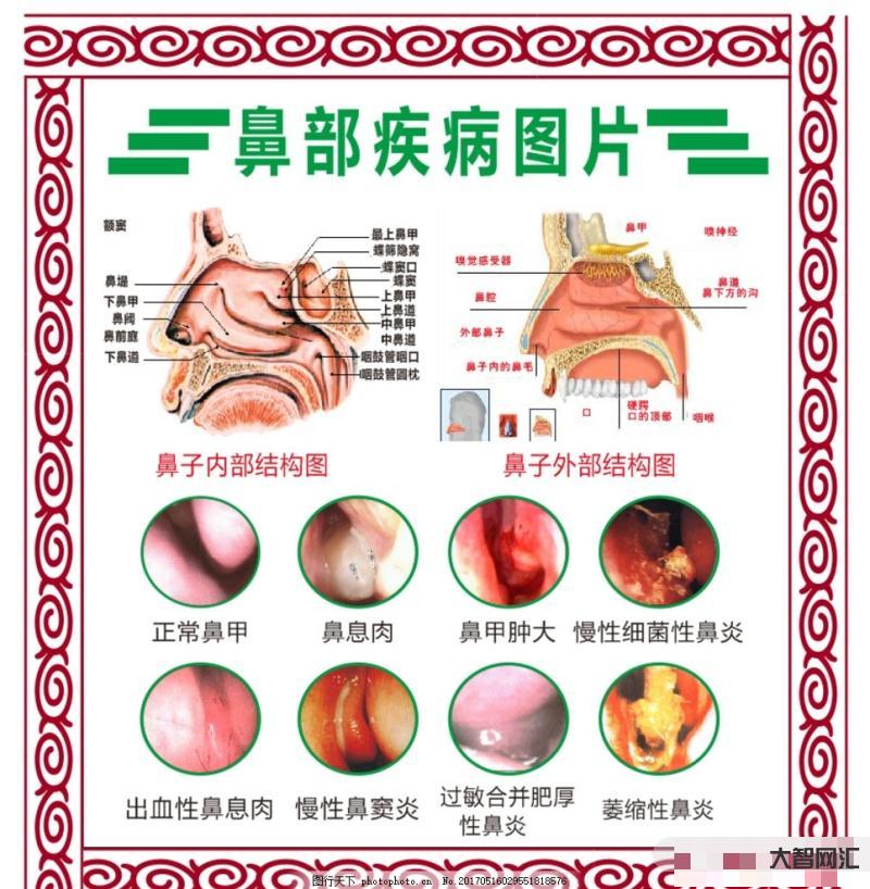 鼻炎的症状都有哪些-鼻炎症状及日常护理-大智网汇