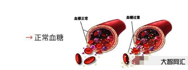 血糖高的症状有哪些症状-糖尿病患者注意:判断自己病情是否加重,这4个信-大智网汇