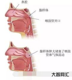 给大家科普下6岁小孩老是清嗓子吭吭的如何办,孩子不停的清嗓子叫什么原因-大智网汇