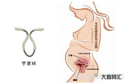 上环需要多少钱可以报销吗,女人上环一般要多少钱-大智网汇