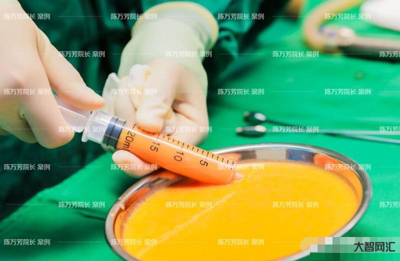抽脂肪对身体有什么副作用-吃肉,能让血脂升高多少?医生解读:食物中的脂-大智网汇