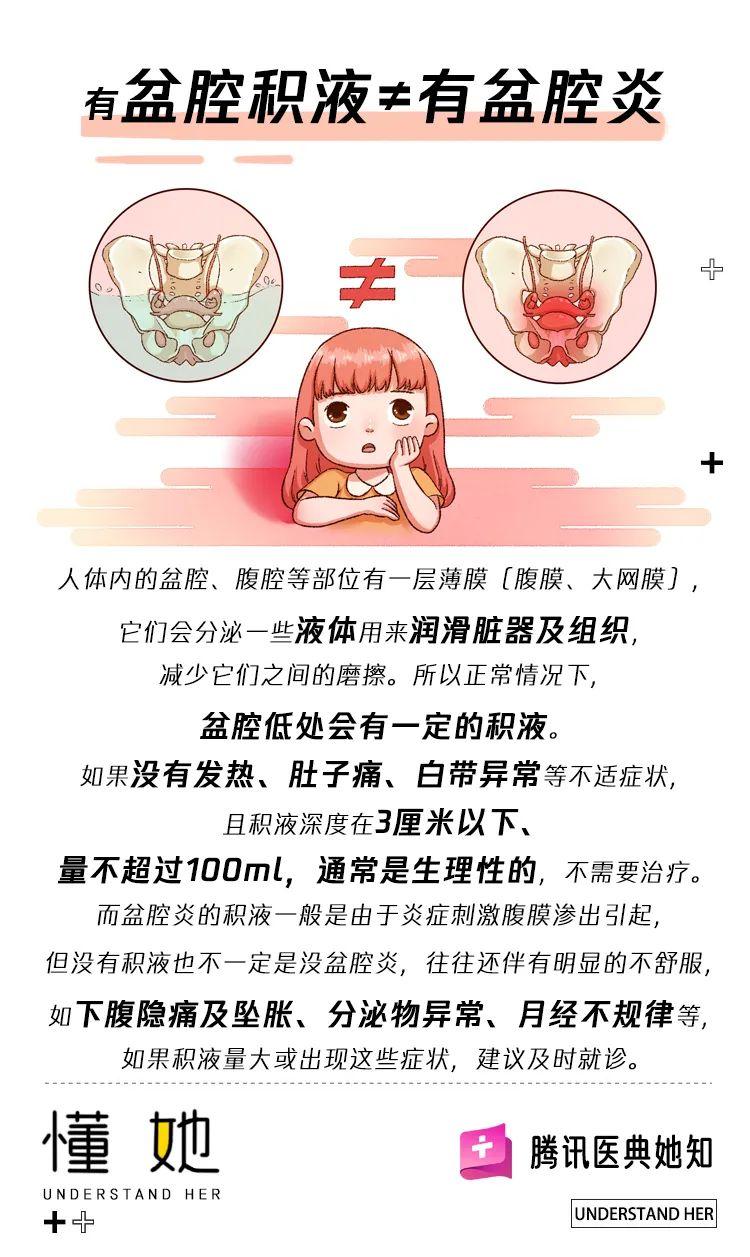 盆腔积液是什么原因造成的-体检发现盆腔有积液,一定要治疗吗?来听听医生-大智网汇