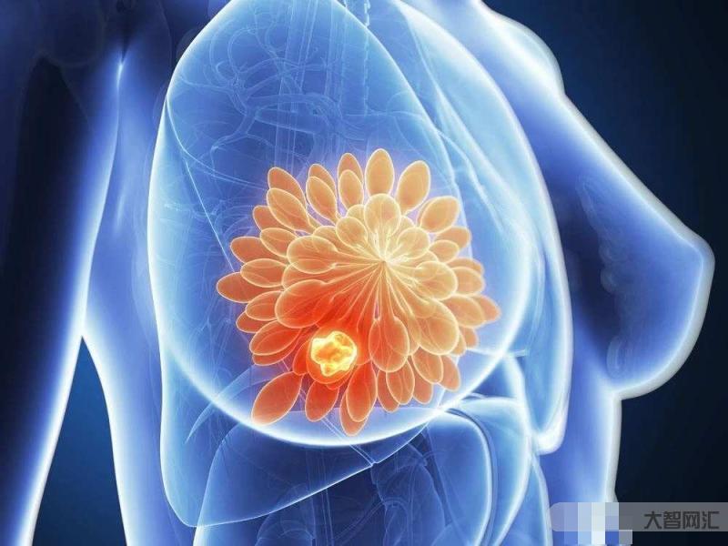 乳腺增生的主要症状有哪些-乳腺增生有哪些症状?-大智网汇