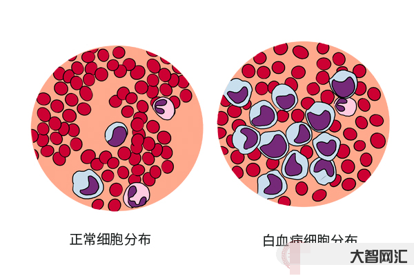 白细胞低是什么问题-体检发现白细胞减少了,是疾病的信号,谨防是这些病因-大智网汇