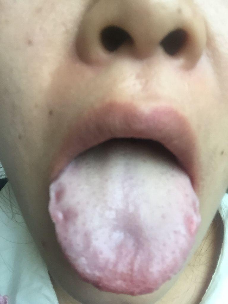 舌苔发黄厚腻是什么原因怎么调理-舌苔发黄、厚腻,要不要刮了它?看完你就-大智网汇
