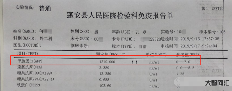 甲胎蛋白偏高说明什么问题-甲胎蛋白升高不一定是肝癌!但很可能有这几种情-大智网汇