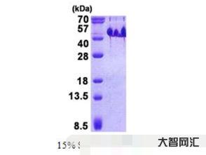 abundant(abundant和abandon) abundant(abundant和abandon)