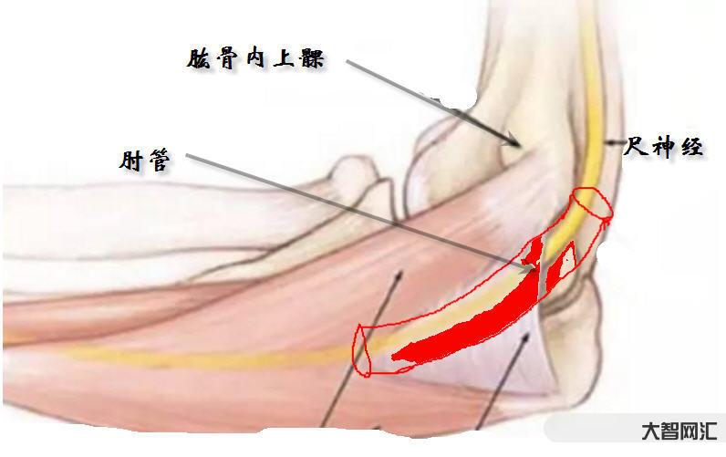 雷特综合症是什么症状-运动训练或可减轻罕见病雷特综合征症状-大智网汇
