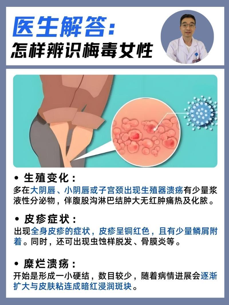 女人性渴望的8大症状-女性性欲异常的表现与应对方法 女人性渴望的8大症状-女性性欲异常的表现与应对方法