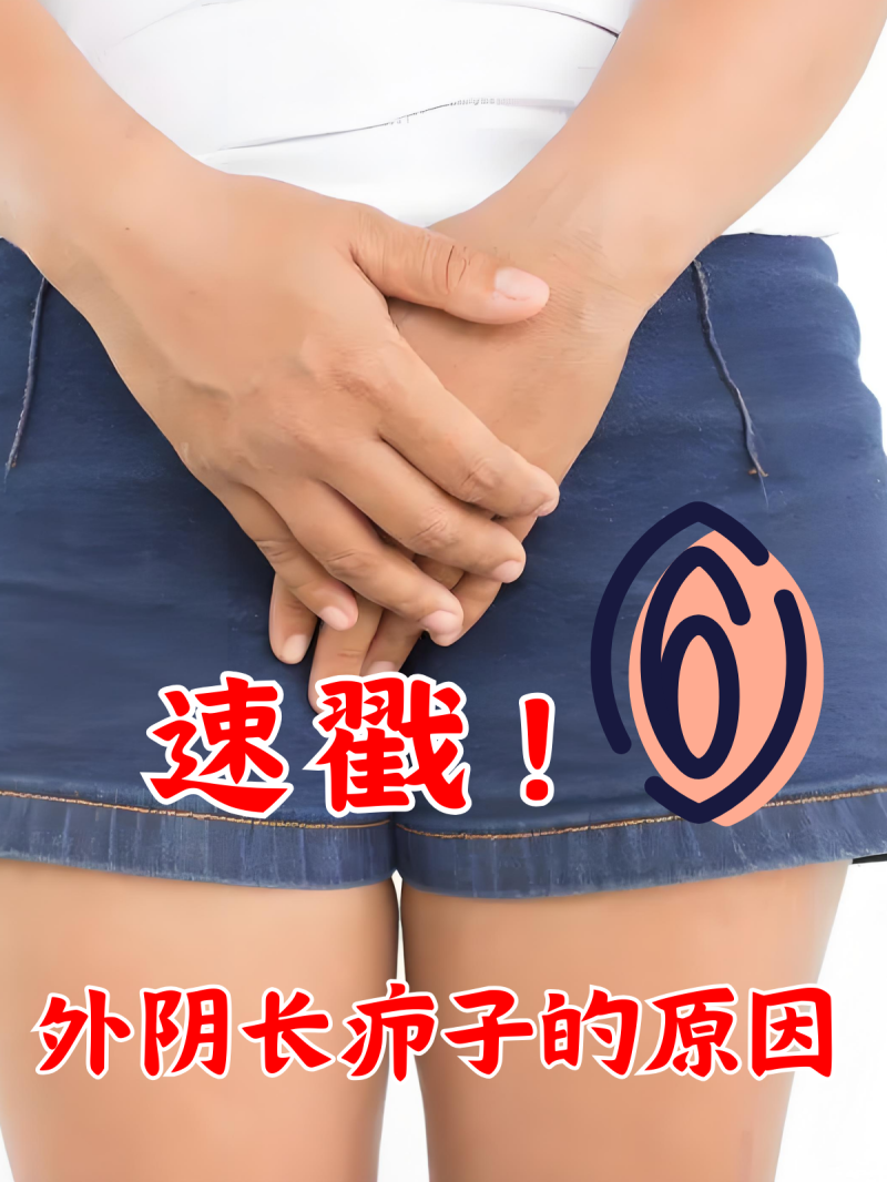 女性私处蹲下拍照有疙瘩怎么办-女性私处蹲下拍照出现疙瘩的原因及处理方法-大智网汇